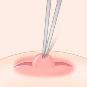 콘텐츠 이미지