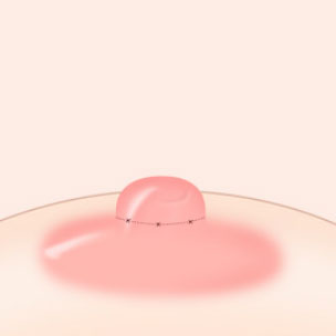 콘텐츠 이미지