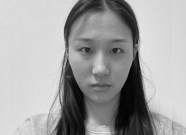 눈 before 이미지