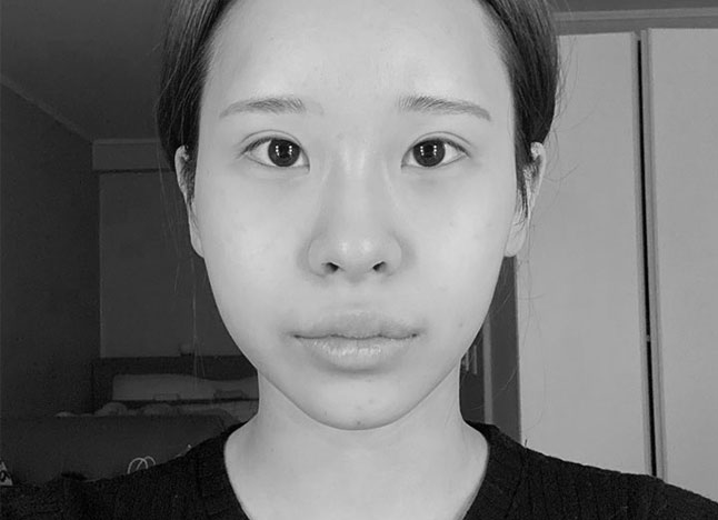 눈 before 이미지