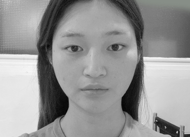 눈 before 이미지