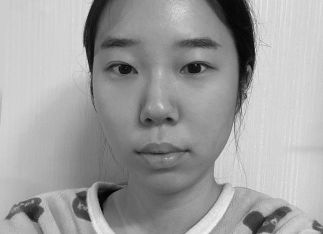 눈 before 이미지