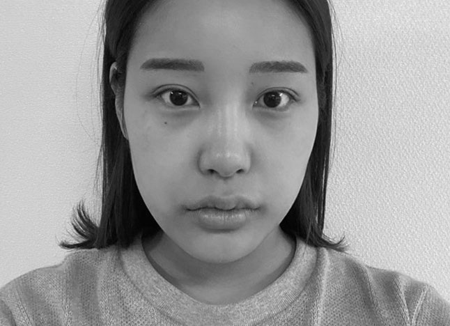 가슴 before 이미지