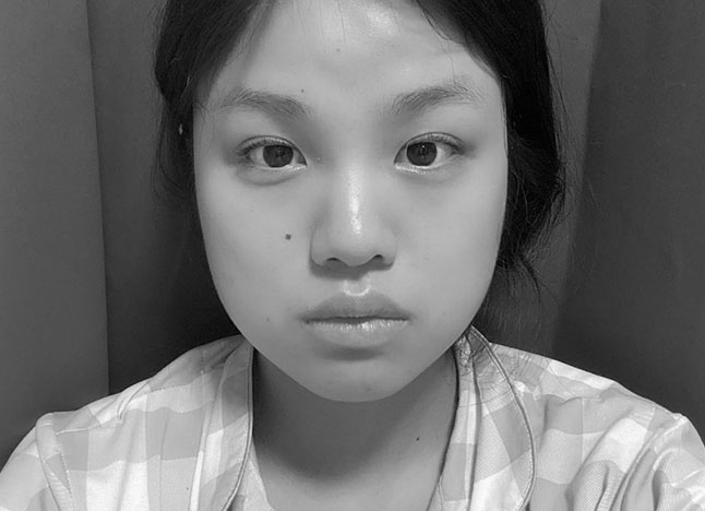 가슴 before 이미지