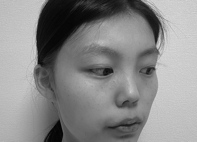 가슴 before 이미지
