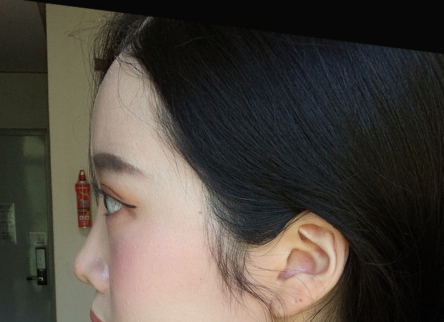 가슴 after 이미지