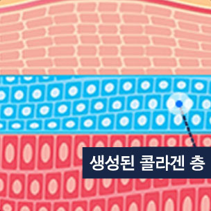 콘텐츠 이미지