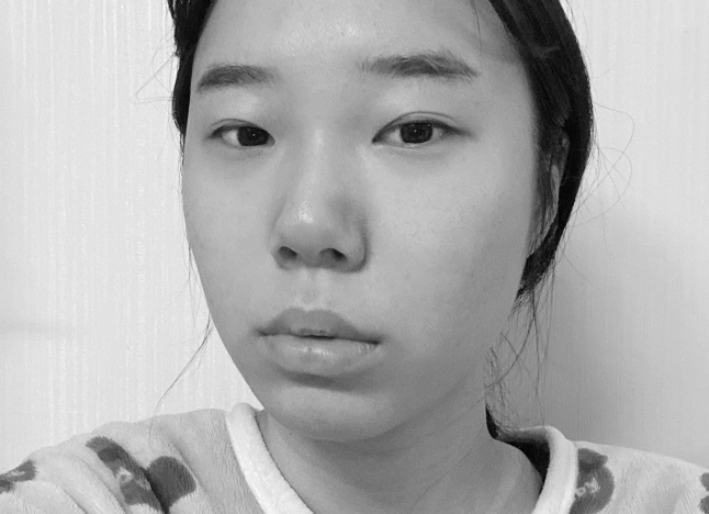 가슴 before 이미지
