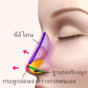 콘텐츠 이미지