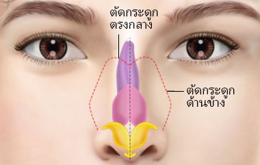 콘텐츠 이미지
