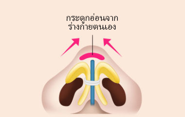 콘텐츠 이미지