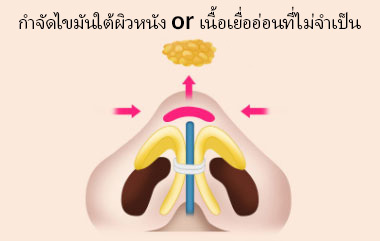 콘텐츠 이미지