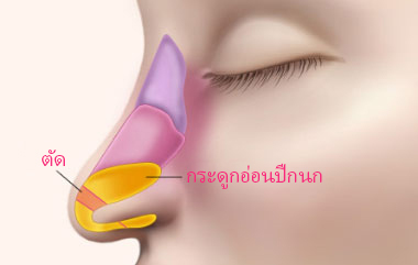 콘텐츠 이미지