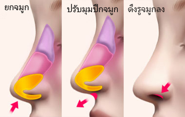 콘텐츠 이미지