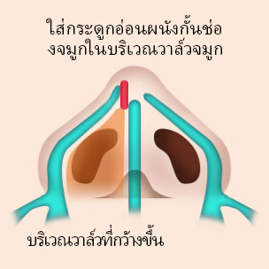 콘텐츠 이미지