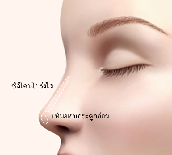 콘텐츠 이미지