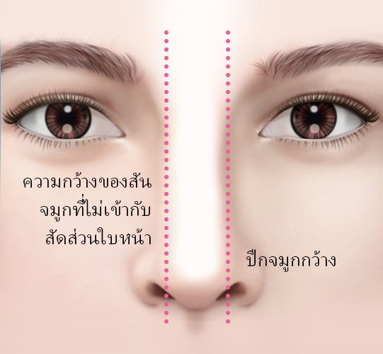 콘텐츠 이미지
