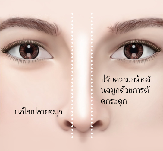콘텐츠 이미지