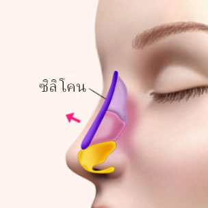 콘텐츠 이미지