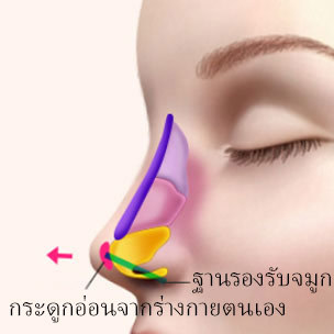콘텐츠 이미지